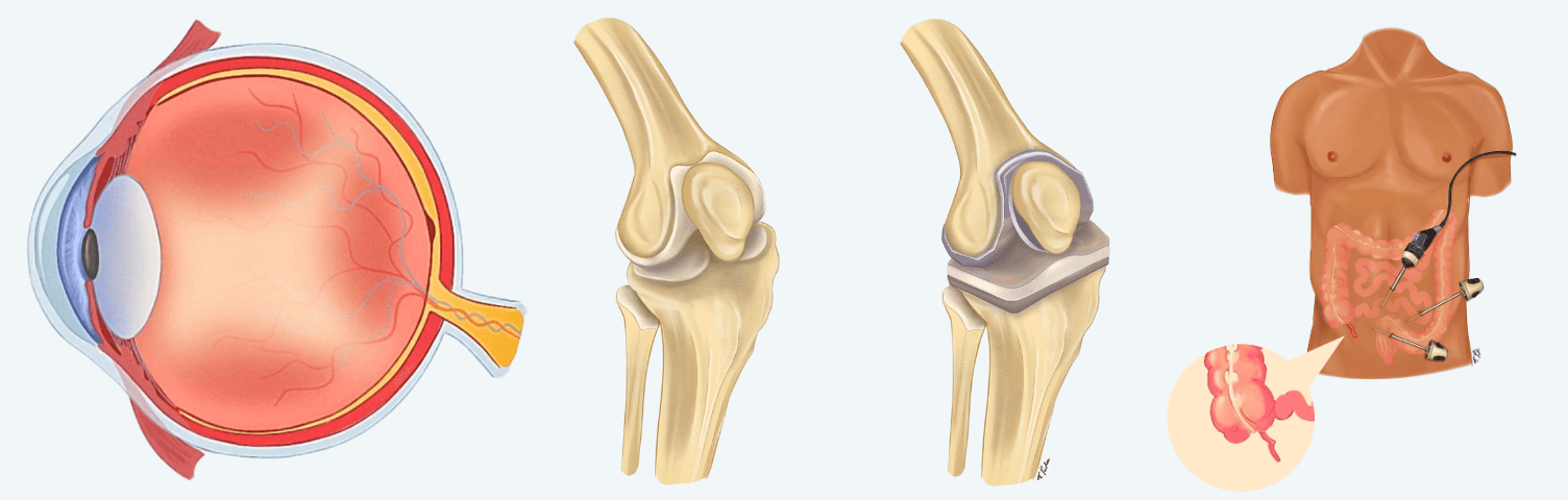 Three of Terouz's illustrations - an eye, knee replacement and appendicectomy